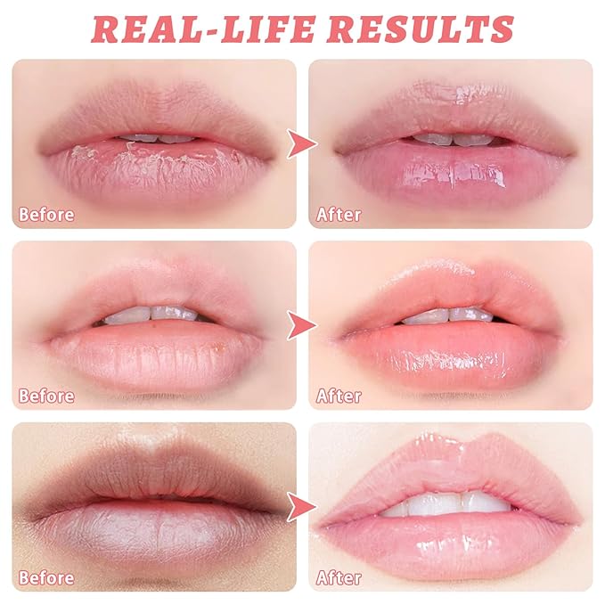 3 PCS Bee Lip Balm Honey Pot, Honey & Strawberry & Watermelon Lip Mask Overnight Propolis Moisturizing Lip Balm Hydrating Prevention Dry and Crack Lip Scrubs Exfoliator Lip Wrinkle Care (Set B)