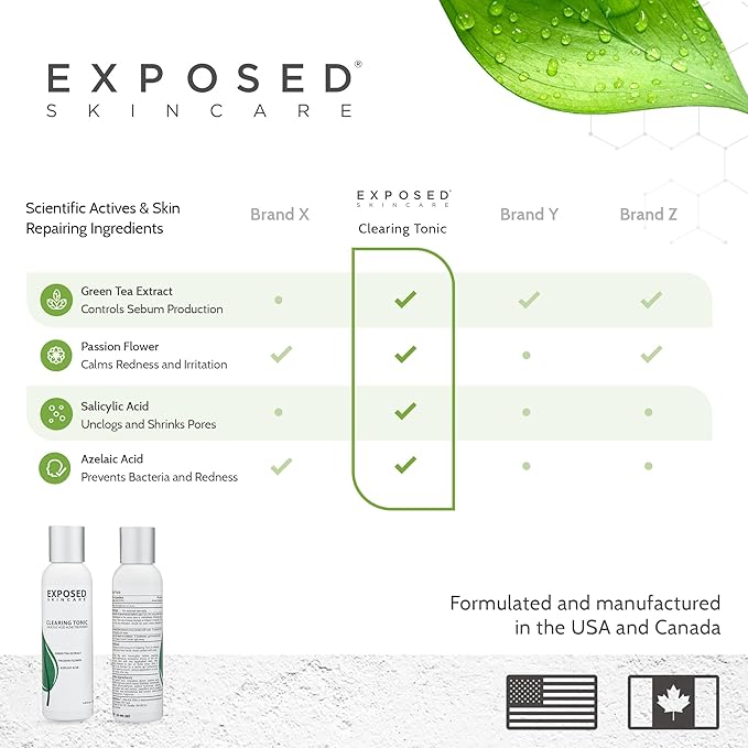 Exposed Skin Care Clearing Tonic Facial Toner with 1% Salicylic Acid and Witch Hazel for Acne Treatment – Pore Minimizing Toner to Prevent Breakouts, Reduce Redness and Balance Skin – Step 2 (4 fl oz)