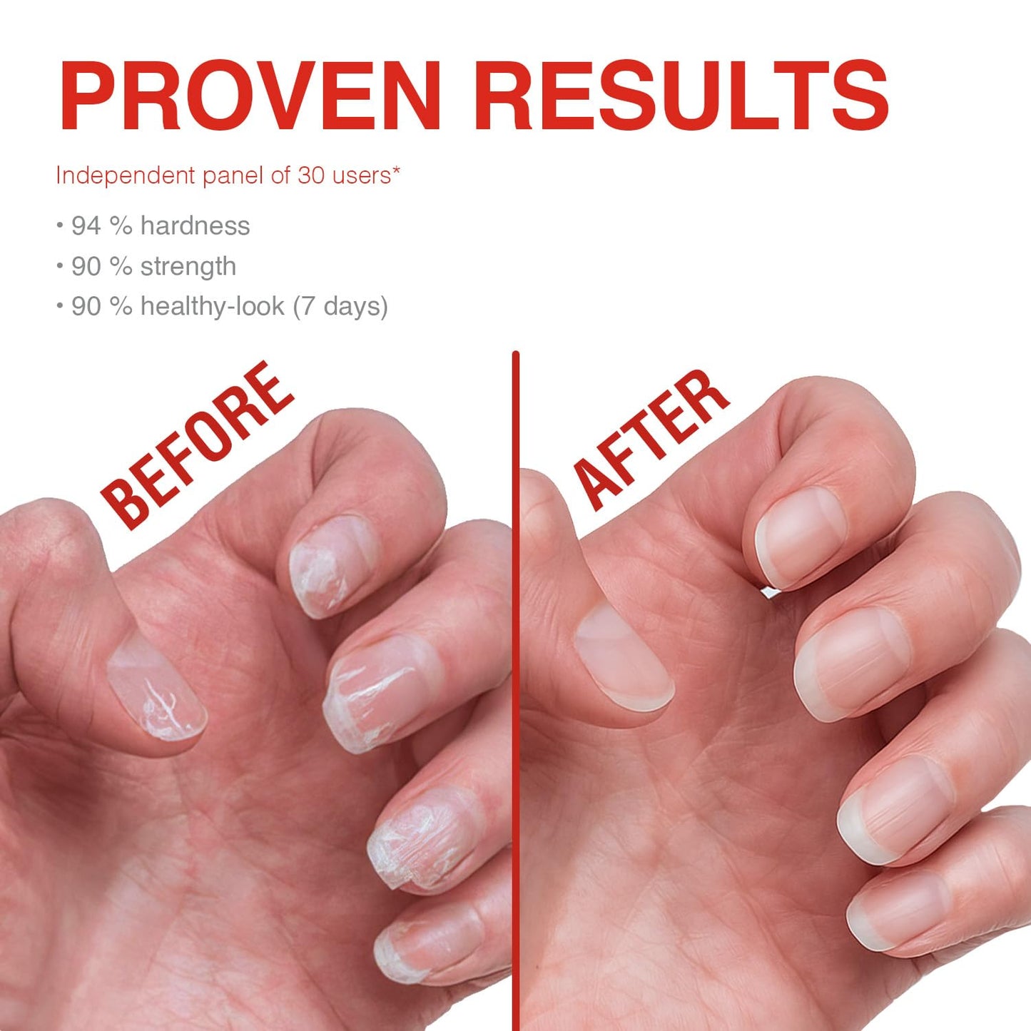 Probelle Nail Strengthener, Nail Strengthening Treatment, Nail Growth and Repair, Stops Peeling, Splits, Chips, Cracks, and Strengthens Nails (0.50 ounces, 3)