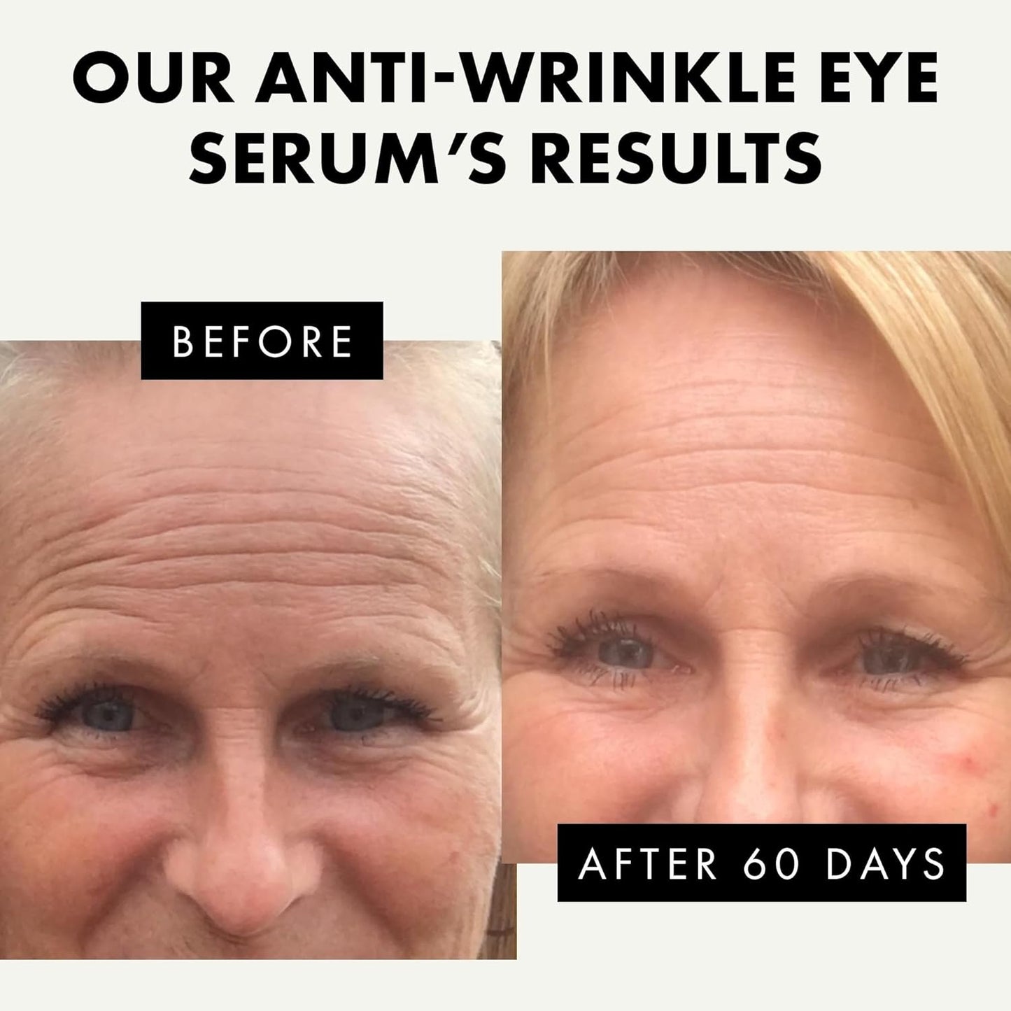 𝗧𝗢𝗣 𝟮𝟬𝟮𝟯* Eye Serum - Under Eye Cream for Dark Circles and Puffiness - Anti Aging Eye Cream, Under Eye Brightener Eye Bags Eye Treatment, Caffeine Eye Cream Puffy Eyes Treatment Dark Circle