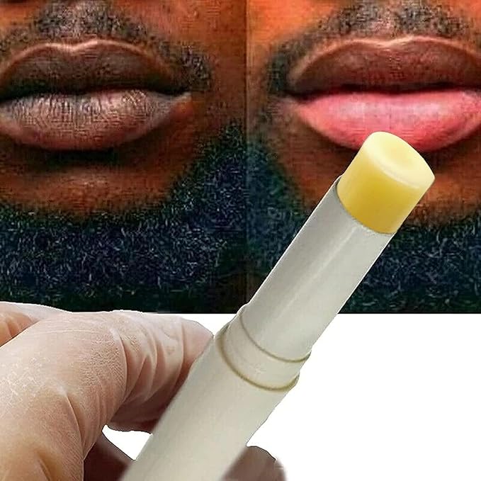 2PC Lip Balm Fade Dark Pigment Whitening Moisturizing Lip Hyaluronic Acid Exfoliating Dead Skin Lightening Lip Care (Yellow)