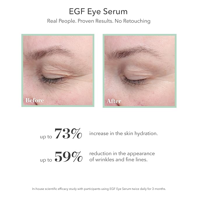 BIOEFFECT Classic Duo of EGF Serum and EGF Eye Serum plus Refill, Skincare Gift Set for Wrinkle Fighting, Moisturizing, Firming, Anti-Aging Facial Treatments featuring Barley Growth Factor