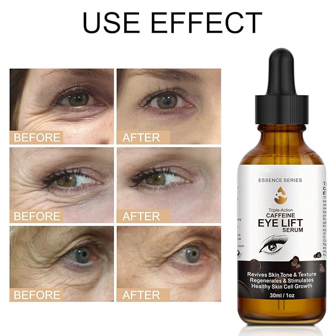 2 PCS Caffeine Eye Serum - Eye Cream for Dark Circles and Puffiness, with EGCG, Ascorbic Acid, Collagen, Caffeine Eye Lift Serum Reduces Under Eye Bags Wrinkles and Fine Lines- 2 oz/60 ml