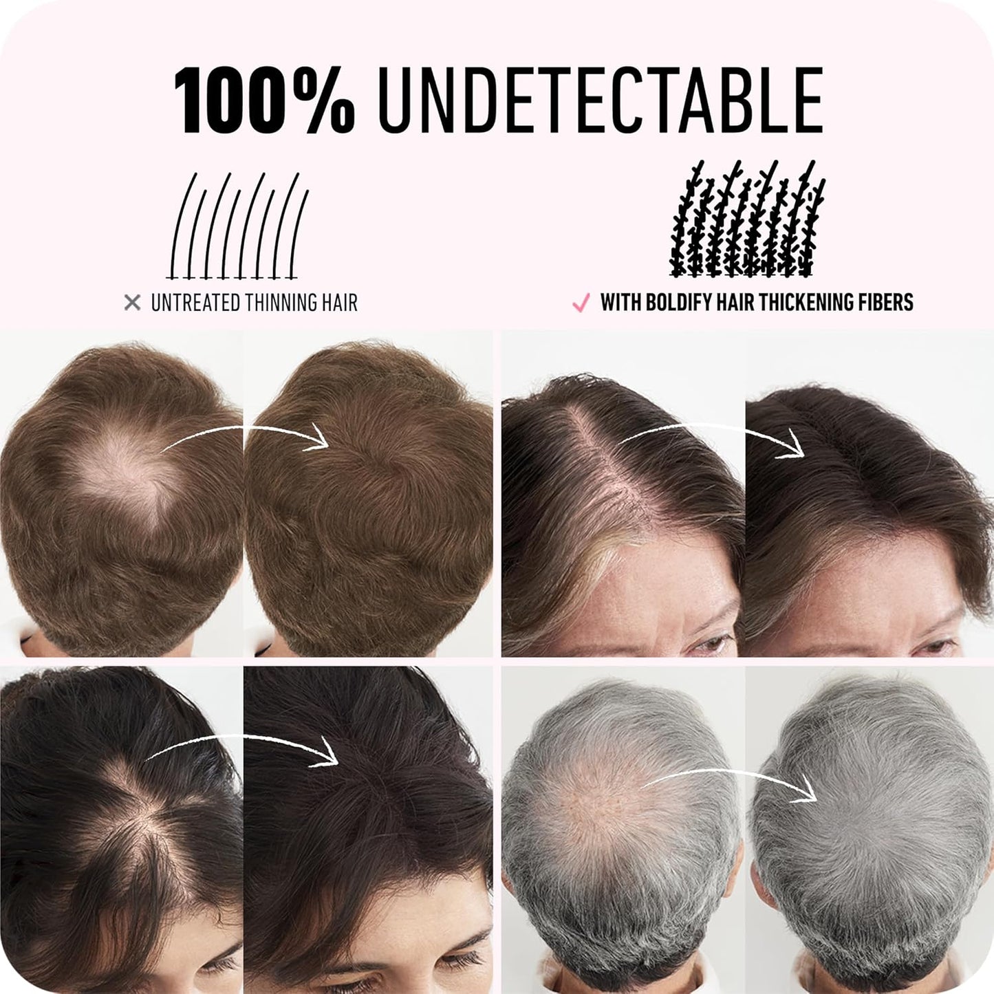 BOLDIFY Hair Fibers (56g) - Fill In Thinning and Fine Hair for an Instantly Fuller, Thicker Look - 14 Shades for Women & Men - Black
