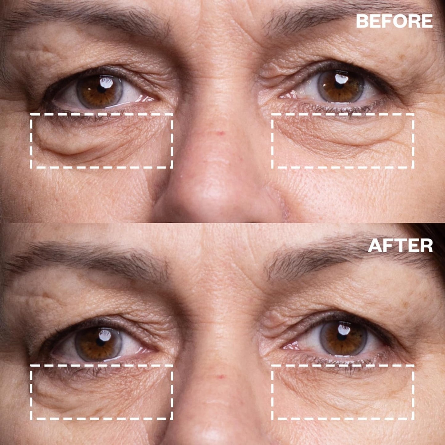 Wrinkles Schminkles Under Eye Wrinkle Patches | Smooth Eye Wrinkles, Crows Feet & Dark Circles Overnight | 1 Pair Reusable Medical Grade Silicone Patches