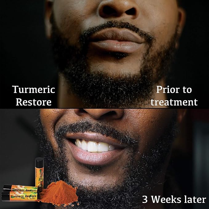 Organic Turmeric Lip Balm 3 Pack - Moisturizing, Balancing, Soothing, Natural Ingredients