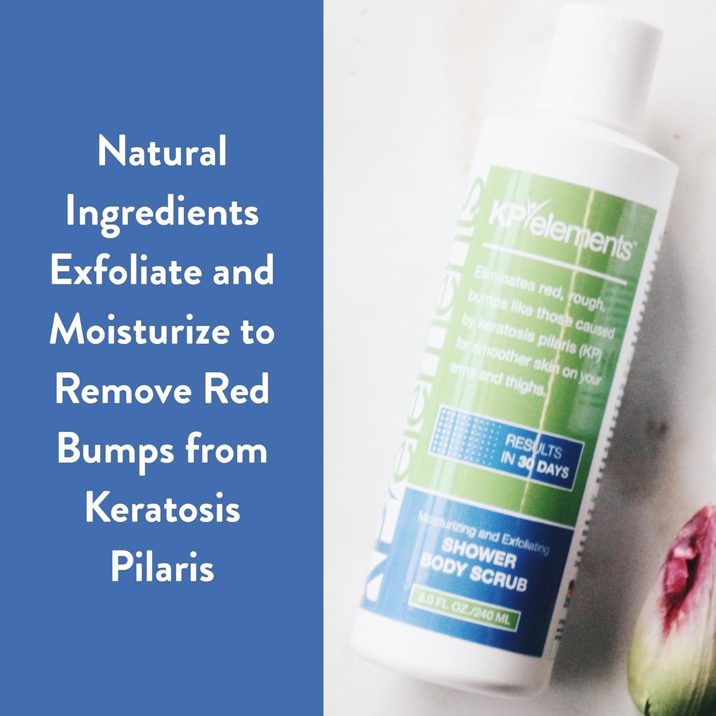 KP Elements Body Scrub (8 fl oz) | Keratosis Pilaris Treatment | Exfoliating Body Scrub and Body Moisturizer for Dry Skin | Helps Reduce Red Bumps | Body Skin Care Product for Men and Women