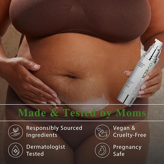 Abera Ovela Maternity Stretch Mark Cream for Pregnancy and Weight Fluctuations, Stretch Mark Treatment Pregnancy Must Haves, Deep Stretch Mark Removal, All Skin Types, 1.69 fl oz