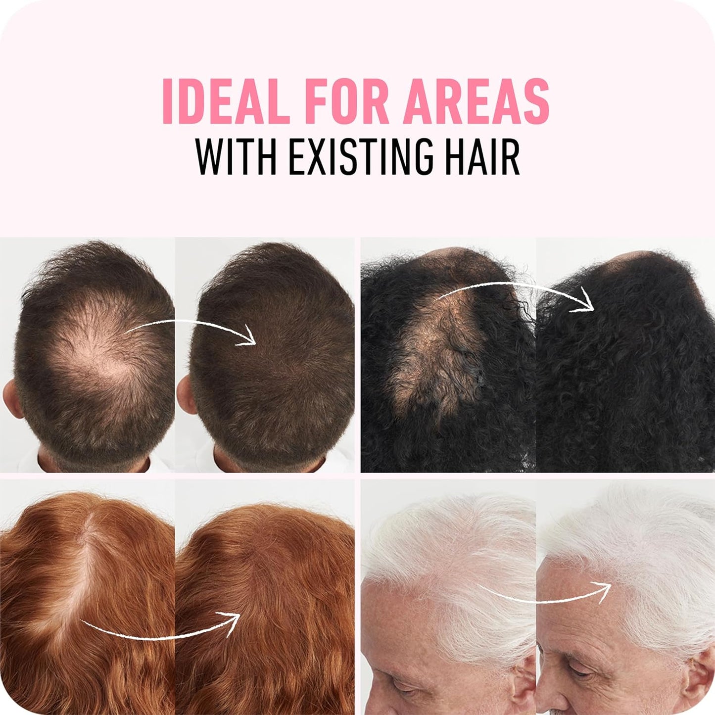BOLDIFY Hair Fibers (56g) - Fill In Thinning and Fine Hair for an Instantly Fuller, Thicker Look - 14 Shades for Women & Men - Dark Blonde