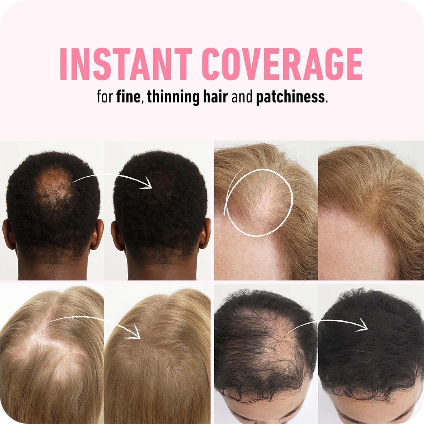 BOLDIFY Hair Fibers (56g) - Fill In Thinning and Fine Hair for an Instantly Fuller, Thicker Look - 14 Shades for Women & Men - Dark Gray