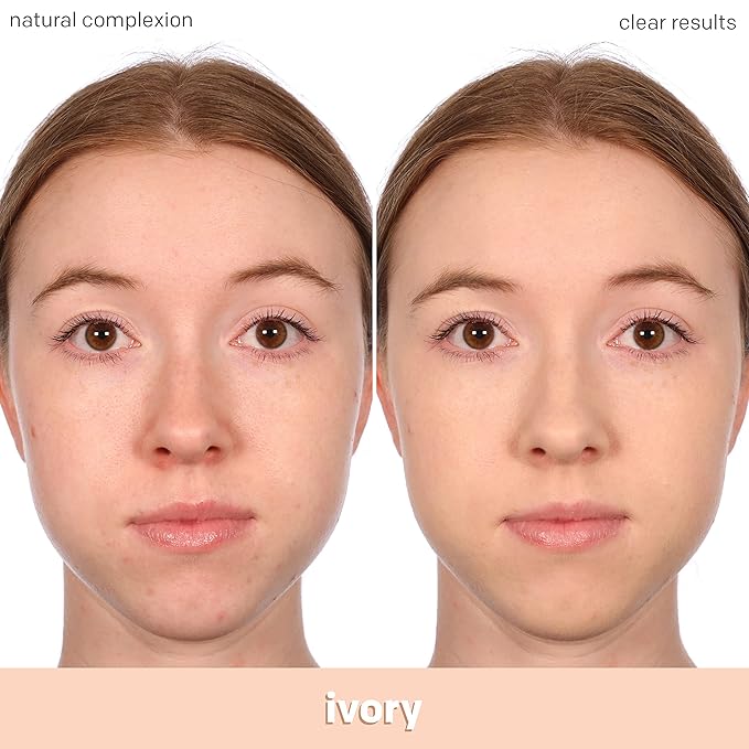Almay Clear Complexion Acne Foundation Makeup with Salicylic Acid - Lightweight, Medium Coverage, Hypoallergenic, Fragrance-Free, for Sensitive Skin, 600 Sun Beige, 1 fl oz.