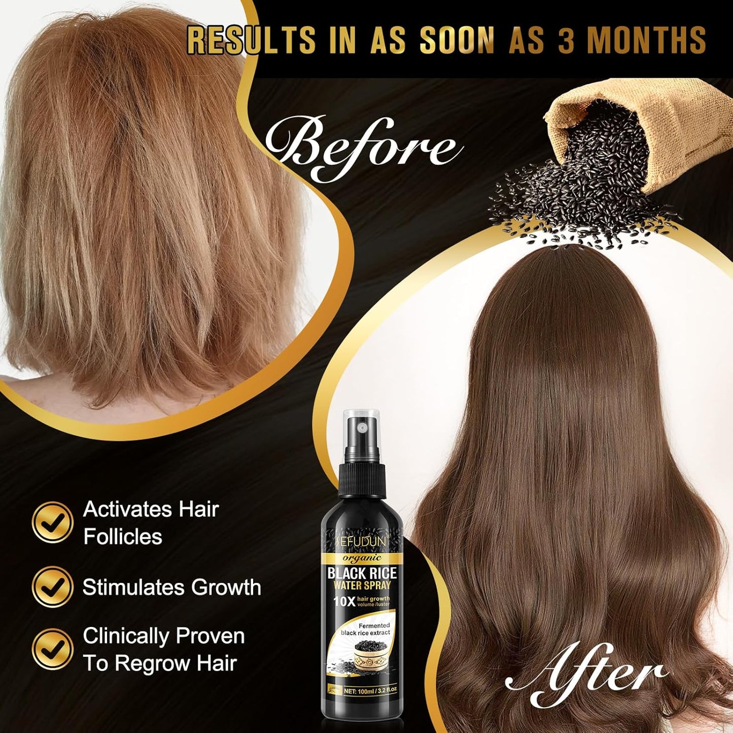Organic Black Rice Water Spray for Hair Growth, A Solution with Castor Oil & Ginger Root Extract for Thicker, Fuller Hair, Targets Hair Loss and Repairs Damage 100ml/3.2 fl.oz (1 PC)
