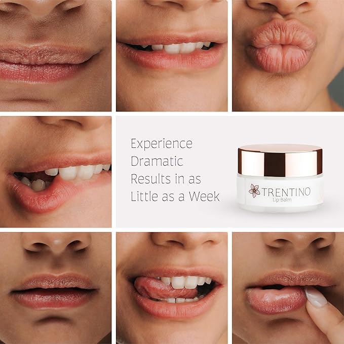 Restore & Plump Coconut Lip Balm – Lip Hydration with Collagen Peptide & Shea Butter & Vitamin E – Lip Plumper/Mask - Lip Repair for Dry Cracked Lips
