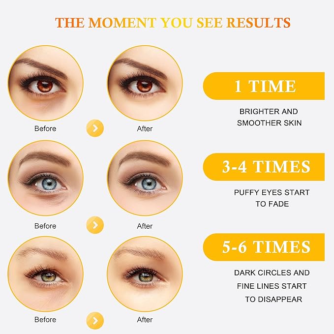 Under Eye Patches for Puffy Eyes, Hot Cold Treatment Cooling Gel Eye Pads Eye Mask for Wrinkles Dark Circles Puffiness Eye Bags，Eye Ice Pack， 6Pair