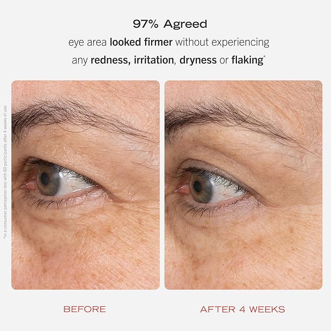 First Aid Beauty Retinol Eye Cream with Squalane + Ceramides – Visibly Smooths Fine Line & Wrinkles Around the Eyes – 0.5 oz.