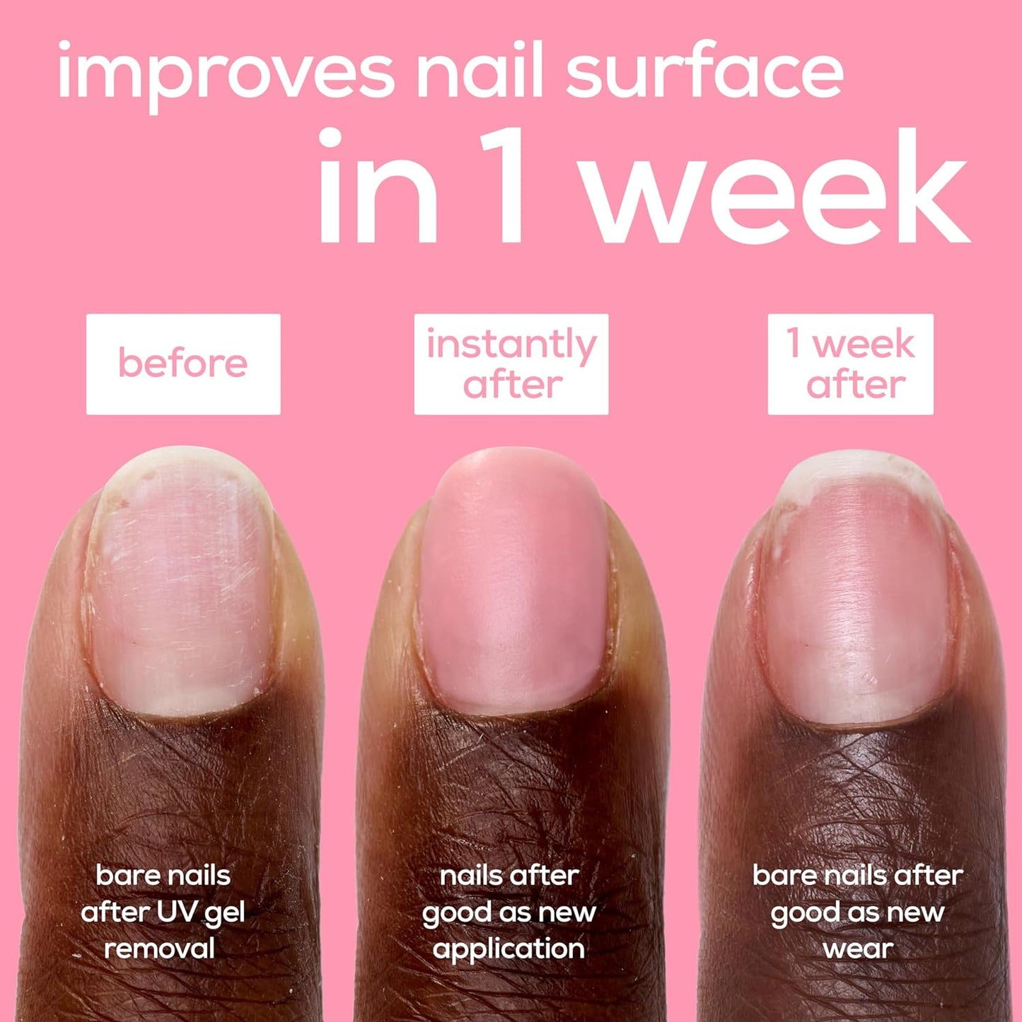 essie Nail Care, Ceramide-Infused Nail Treatment, Vegan, Good As New Concealer & Perfector, 0.46 Fl Oz