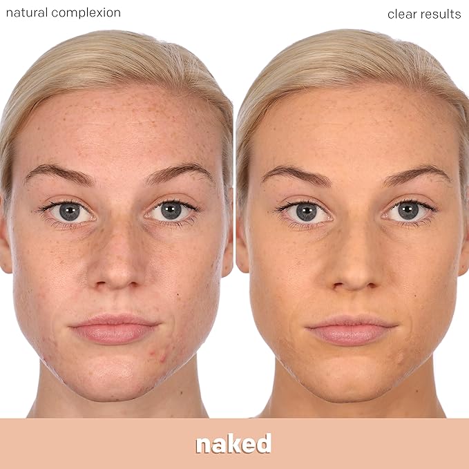 Almay Clear Complexion Acne Foundation Makeup with Salicylic Acid - Lightweight, Medium Coverage, Hypoallergenic, Fragrance-Free, for Sensitive Skin, 300 Naked, 1 fl oz.