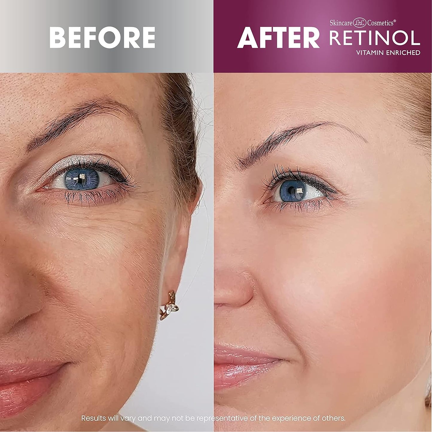 Retinol Anti-Aging Eye Stick – Treatment Balm – Your Beauty Secret for Younger Looking Eyes – Hydrates, Firms, Brightens, and Smooths Fine Lines – Vitamin A, C and E Minimizes Aging Effect on Eyes