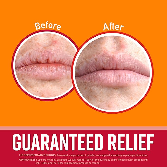 O'Keeffe's Lip Repair Lip Balm with Cherry & Vitamin E Oil, Stick (Pack of 3)