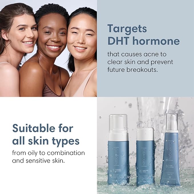 Acne Treatment Kit, Acne Kit, Skin Care Acne, Acne Skin Care Set, Natural Anti-DHT Deluxe Set Sensitive Skin 3-Piece Set, 2-Month Supply