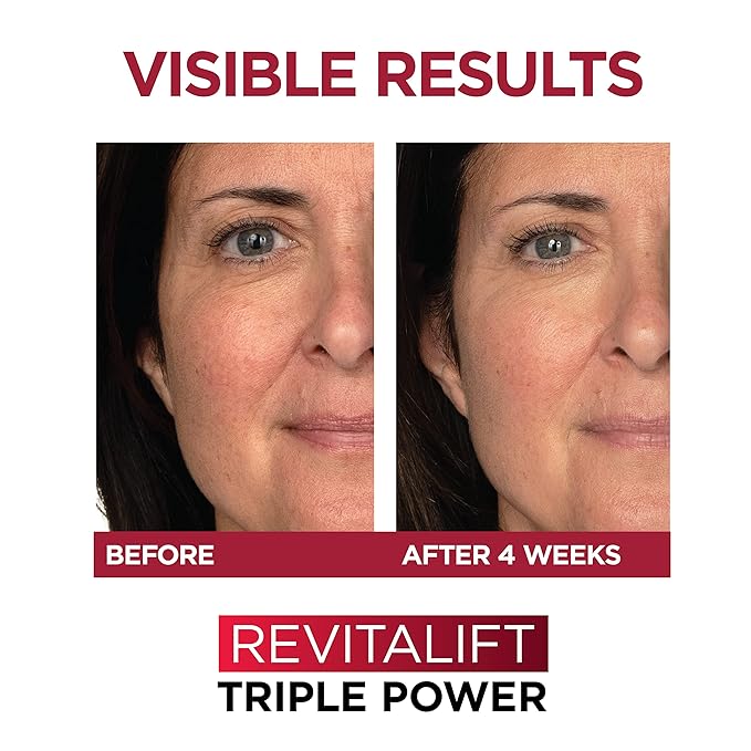 L'Oreal Paris Revitalift 1.5% Pure Hyaluronic Acid Face Serum + Triple Power Anti-Aging Face Moisturizer, 1 kit